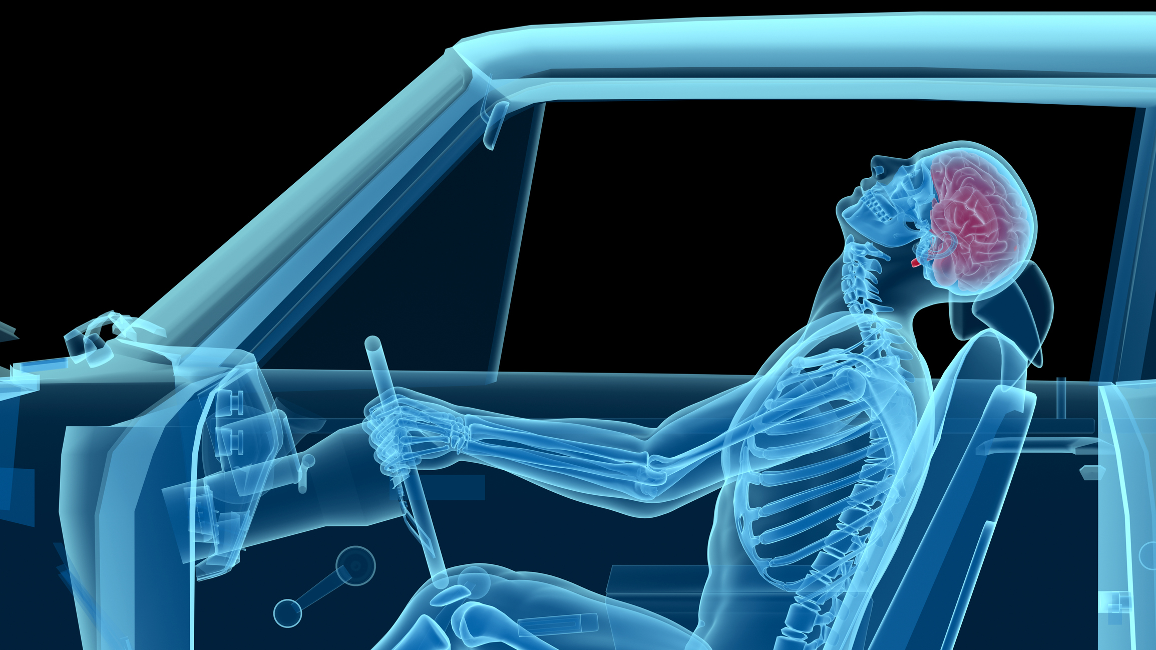 human anatomy in a car crash